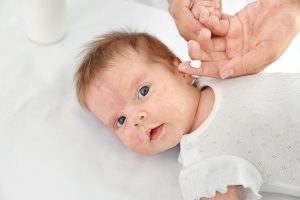 Adorable baby with skin allergy undergoing treatment in hospital